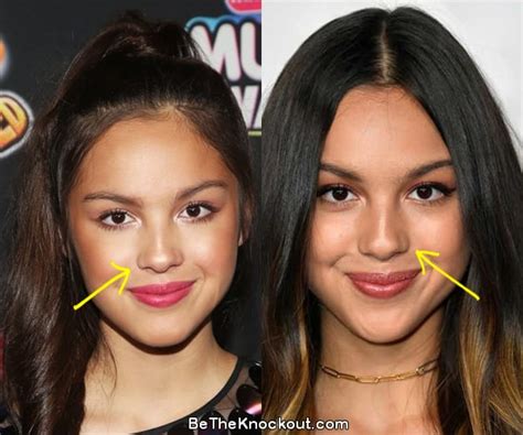 does olivia rodrigo have implants|Olivia Rodrigo Was Slammed With Plastic Surgery。